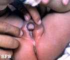 hermaphrodite