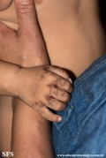 acrodermatitis enteropathica