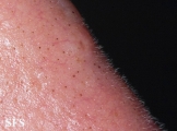 trichostasis_spinulosa