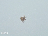 pediculosis palpebrarum