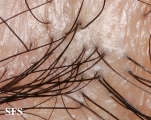 pseudopelade
