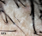 pseudopelade
