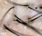 pseudopelade
