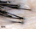 pseudopelade