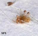 pediculosis pubis
