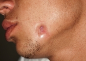 dental_sinus