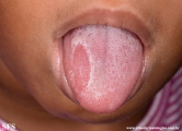 tongue geographic