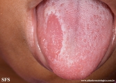 tongue geographic